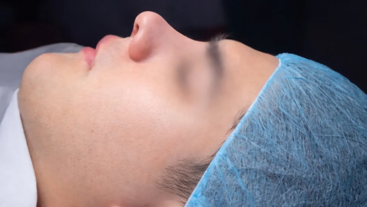 Rinoplastia para hombres: redefiniendo la masculinidad